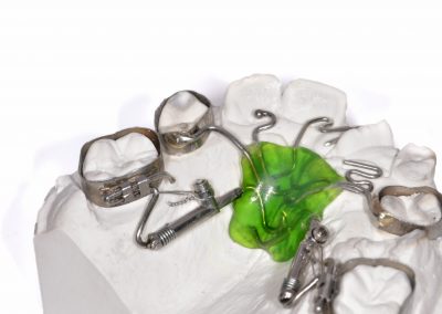 Aparate ortodontice fixe