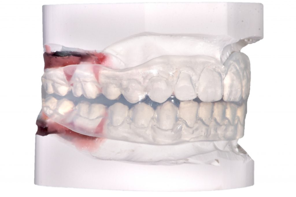 Positioner ORTO PERFORMANCE