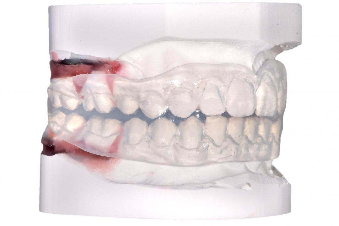 Positioner ORTO PERFORMANCE